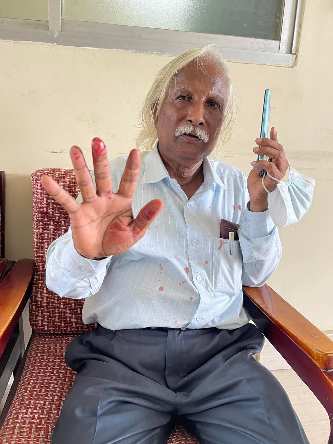 নোয়াখালীতে সাম্যবাদী আন্দোলনের নেতাকর্মিদের ওপর হামলা, আহত-৫