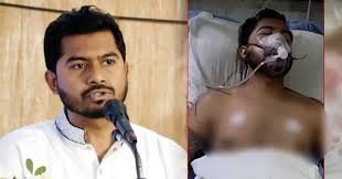 রমনায় সংঘর্ষে আহত নুরুল হক নুরের জ্ঞান ফিরেছে!